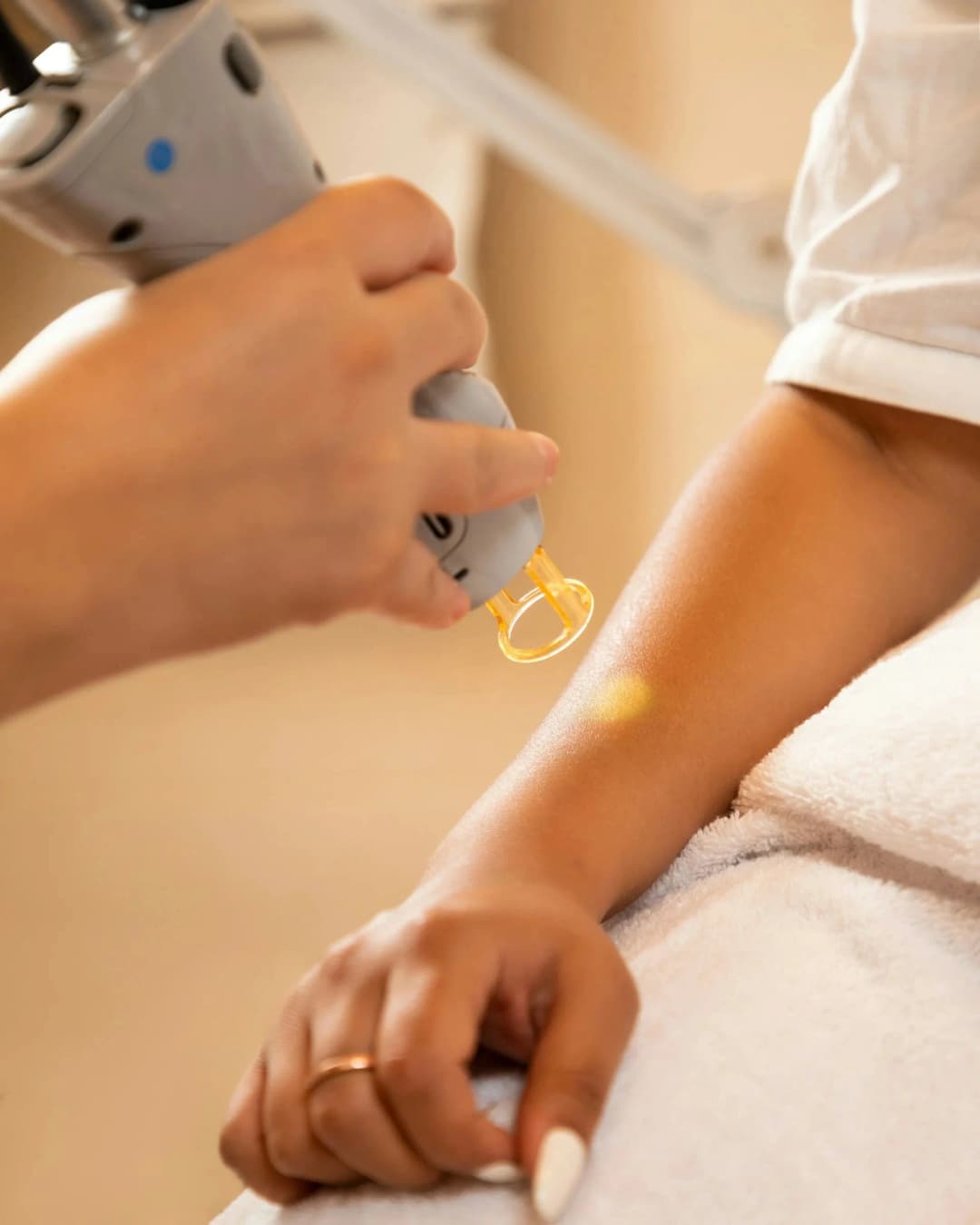 Laser Hair Removal procedure illustration
