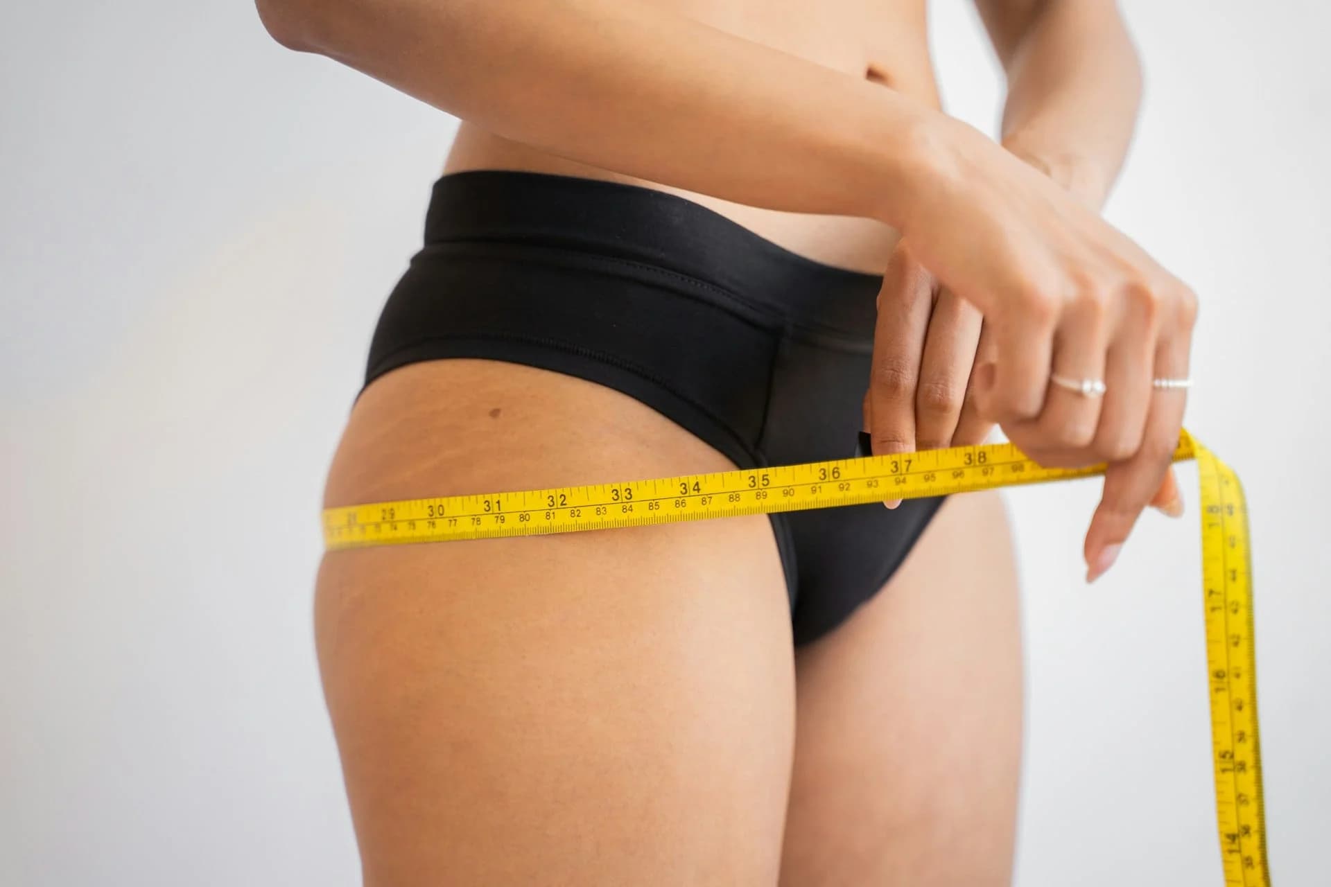 Liposuction