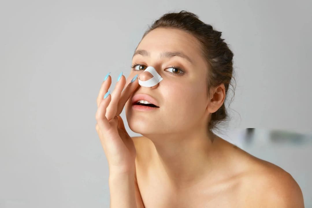Rhinoplasty procedure illustration