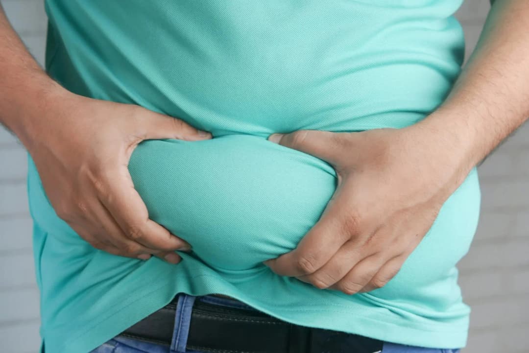 Tummy Tuck procedure illustration